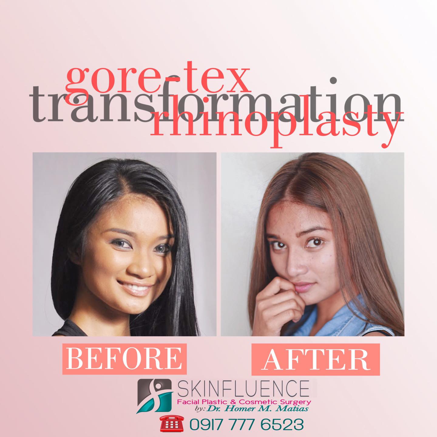 Skinfluence Aesthetic Surgicenter DAVAO 2 BANNER